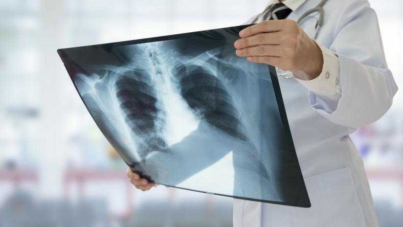 radiografia-preview-default radiografia-preview-default